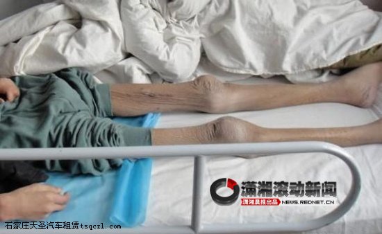 河北唐山劳教所身高1.8米学员去世时仅重35公斤